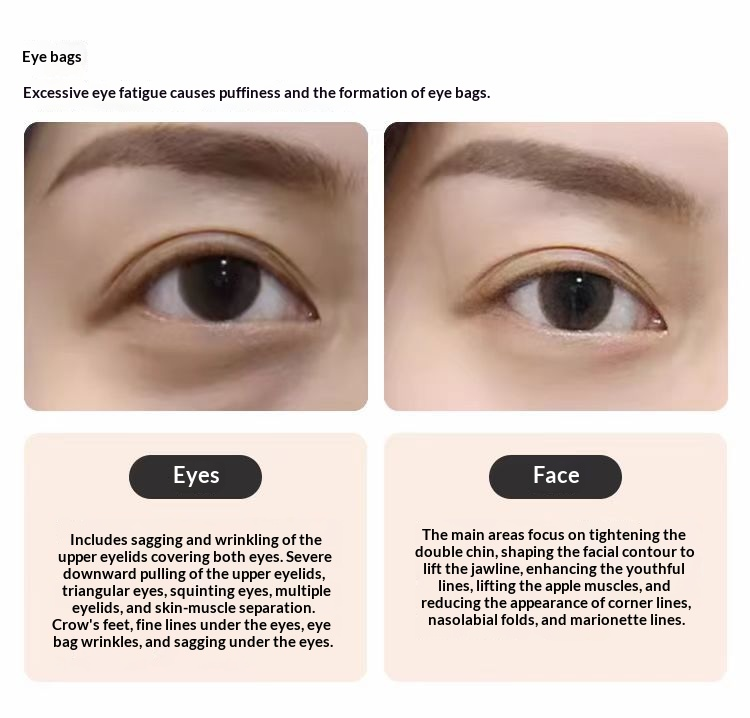 Professional Collagen Induction Beauty Instrument – Eye & Face Lifting, Wrinkle Smoothing, Under-Eye Bag Reducer