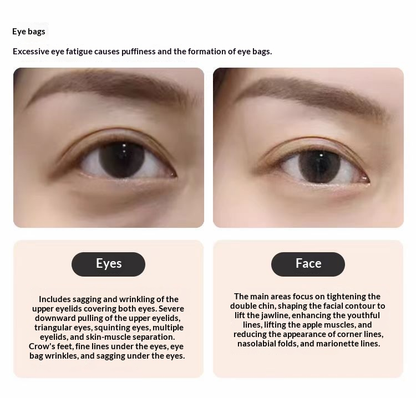 Professional Collagen Induction Beauty Instrument – Eye & Face Lifting, Wrinkle Smoothing, Under-Eye Bag Reducer