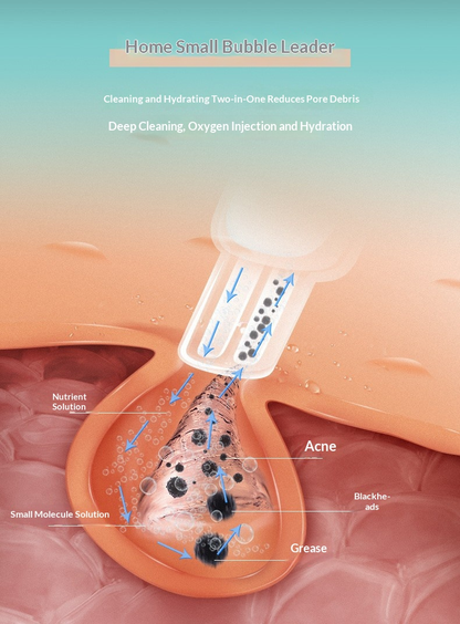 Blackhead Vacuum + Oxygen Spray | Pore Cleansing & Serum Infusion Device